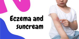 Eczema and suncream