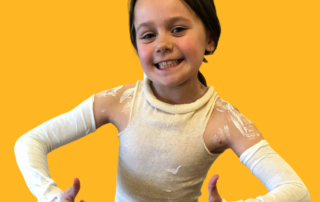 Girl in bandages wrapped to help eczema
