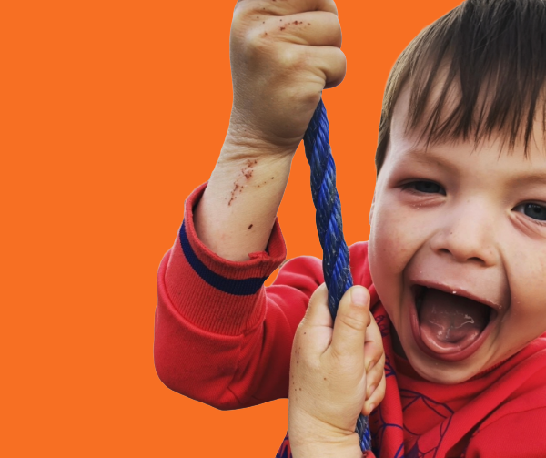 Graphic of brain with 'eczema and mental health' text